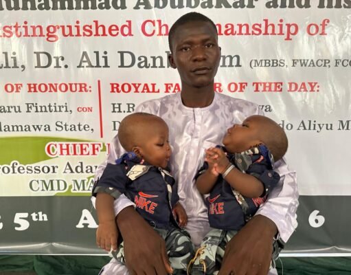 MAUTH Yola discharges separated conjoined twins amidst admiration.